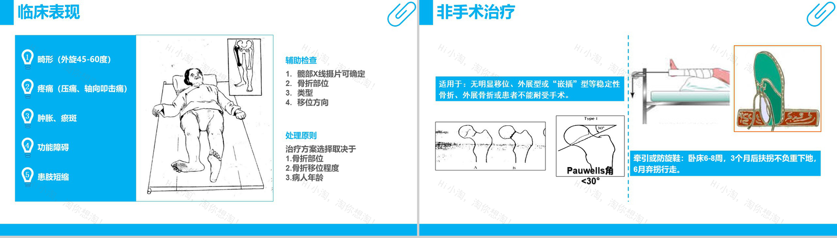 股骨颈骨折护理查房工作汇报PPT模板-9