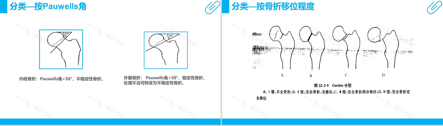 股骨颈骨折护理查房工作汇报PPT模板-8
