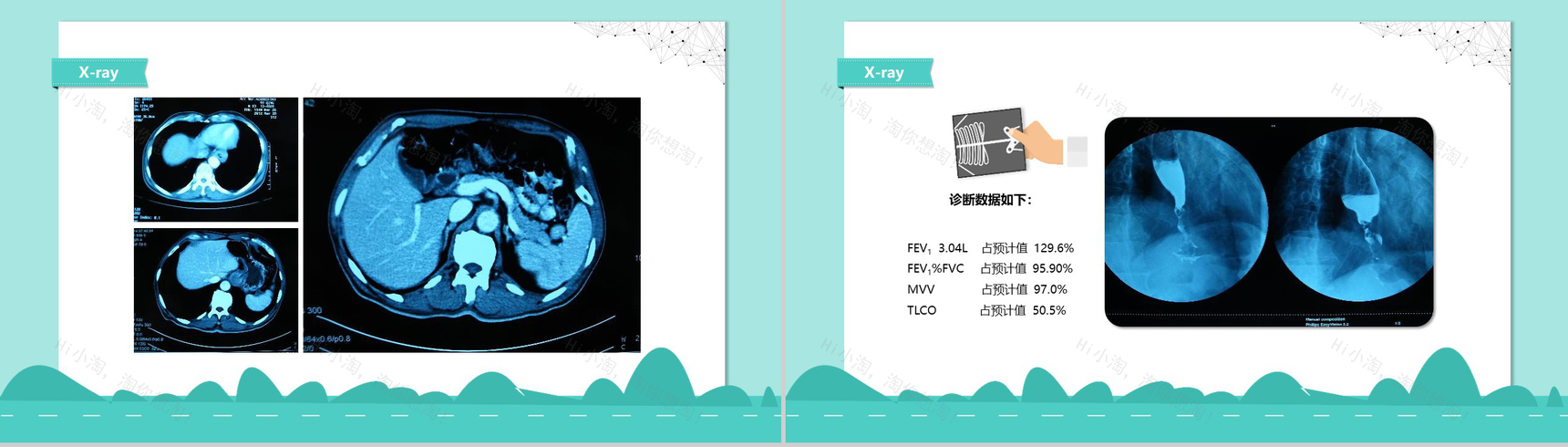 医院病例汇报通用年度汇报PPT模板-6