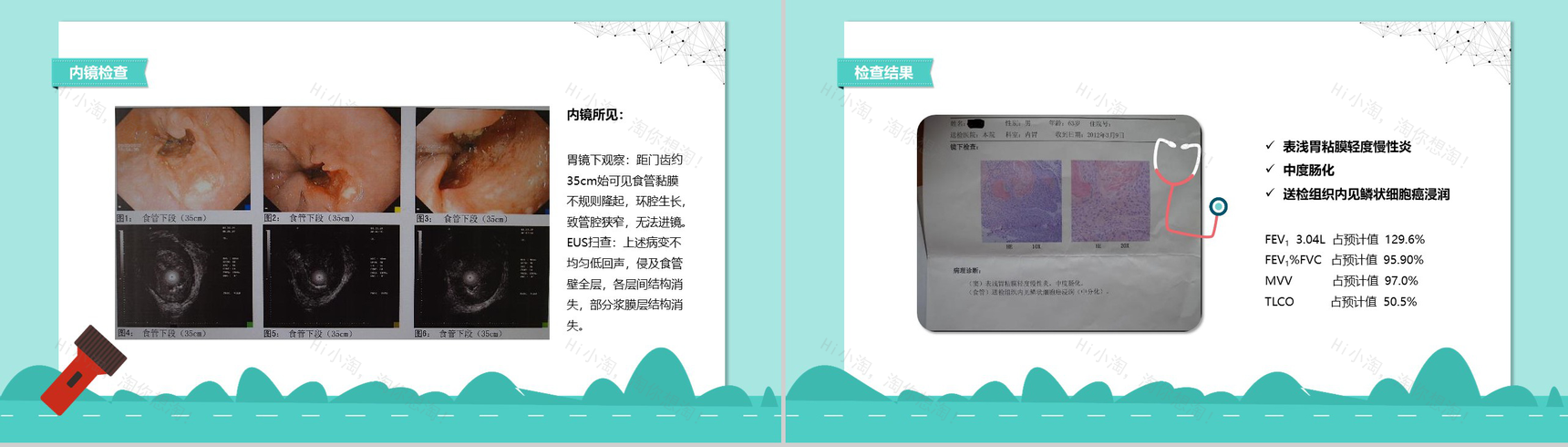 医院病例汇报通用年度汇报PPT模板-7