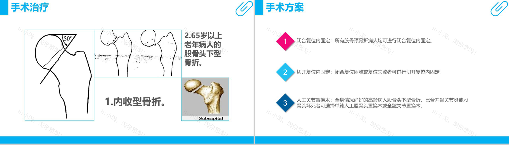 股骨颈骨折护理查房工作汇报PPT模板-10