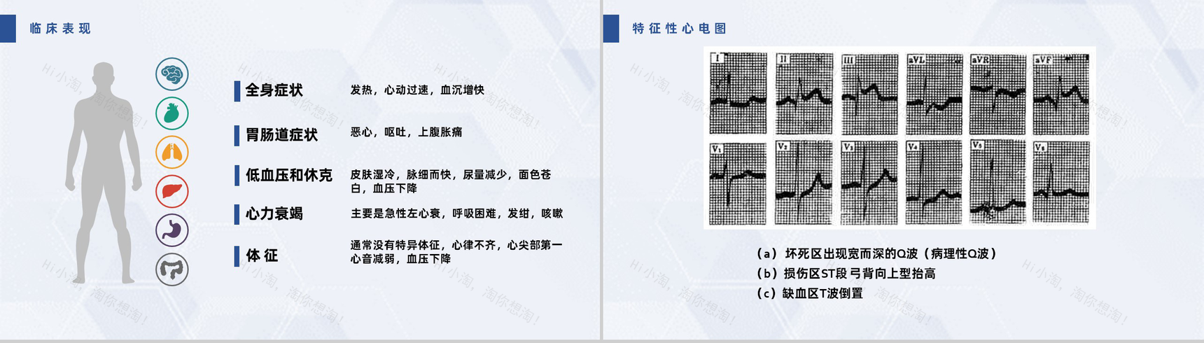 扁平化风格蓝色医疗急性心梗护理查房PPT模板-12