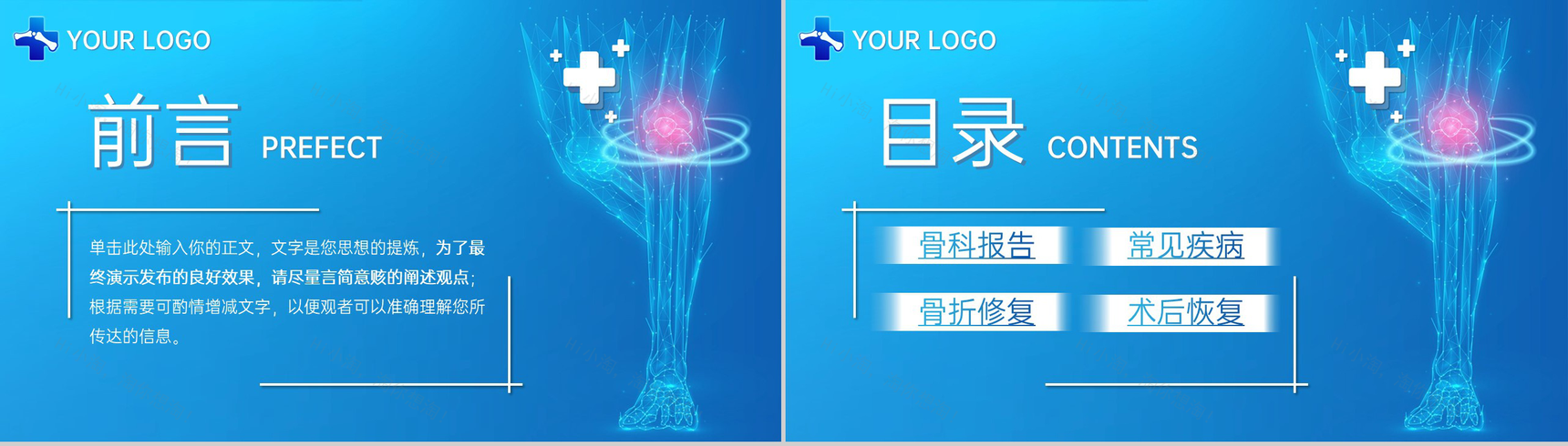 蓝色简洁骨科医生治疗研究报告医学论文答辩PPT模板-2