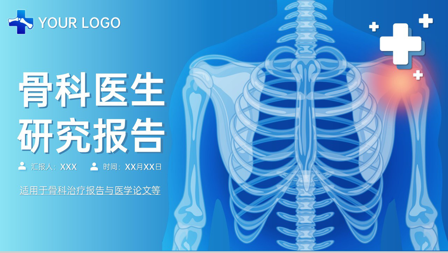 蓝色简洁骨科医生治疗研究报告医学论文答辩PPT模板