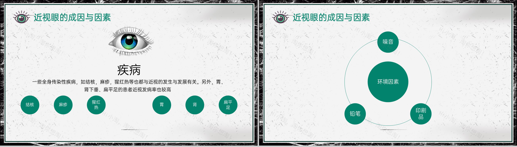 灰色简约世界视力日宣传近视眼的成因与因素主题汇报PPT模板-9